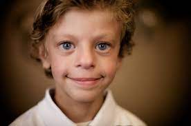 دانلود پاورپوینت بررسی سندروم ویلیامز