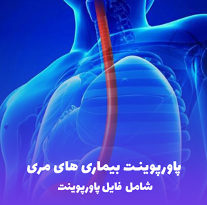 پاورپوینت بیماری های مری | ارائه کامل و قابل ویرایش